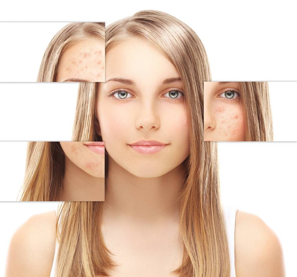 ابر بلازما للشعر والوجه 1024x956 1